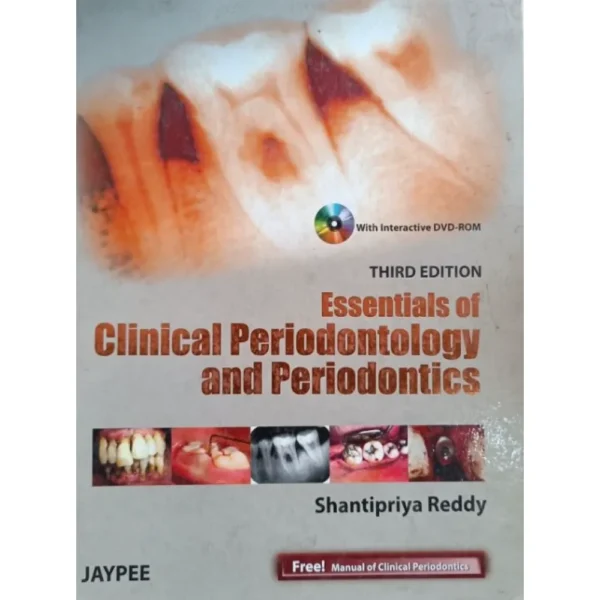 Essentials Of Clinical Periodontology And Periodontics 3rd Edition by Shantipriya Reddy
