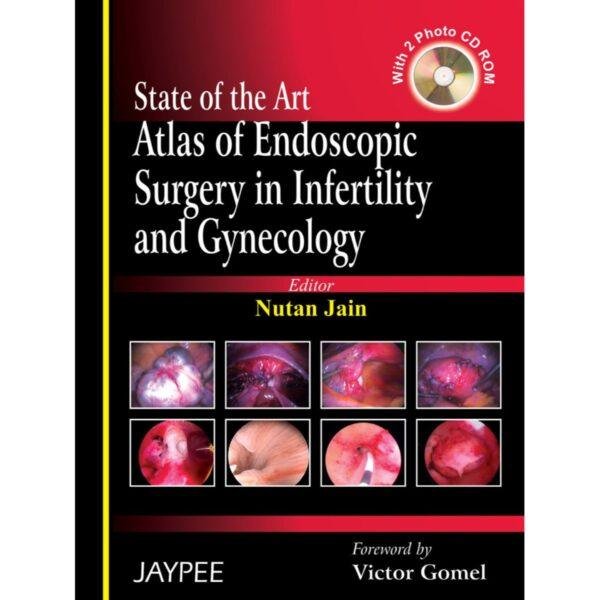 State of the Art Atlas of Endoscopic Surgery in Infertility and Genecology by Nutan Jain